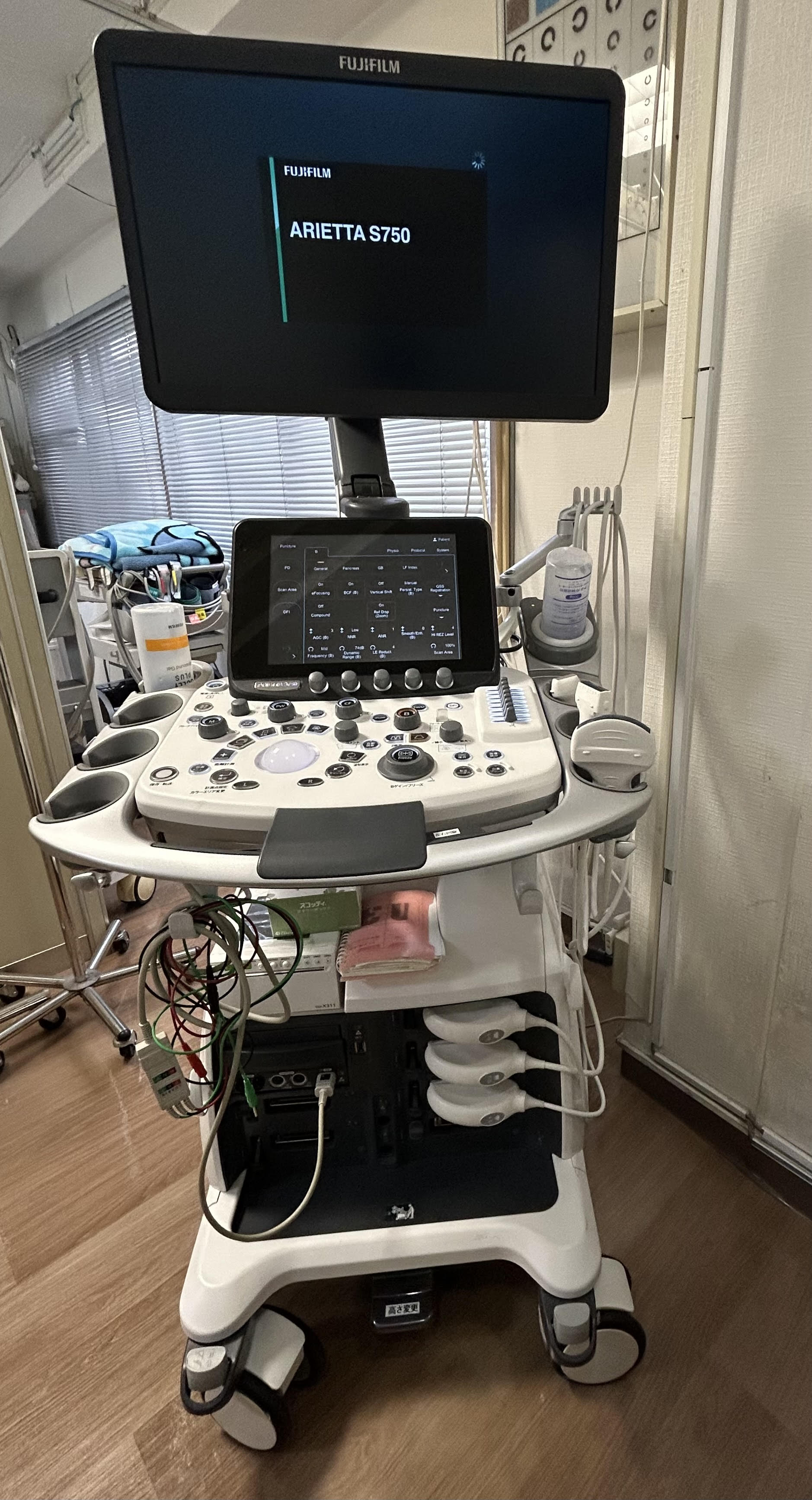 超音波診断装置